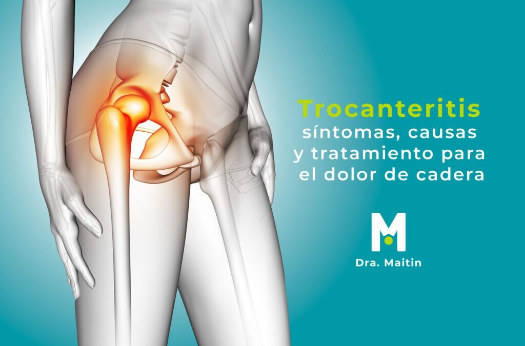 Trocanteritis: síntomas, causas y tratamiento para el dolor de cadera